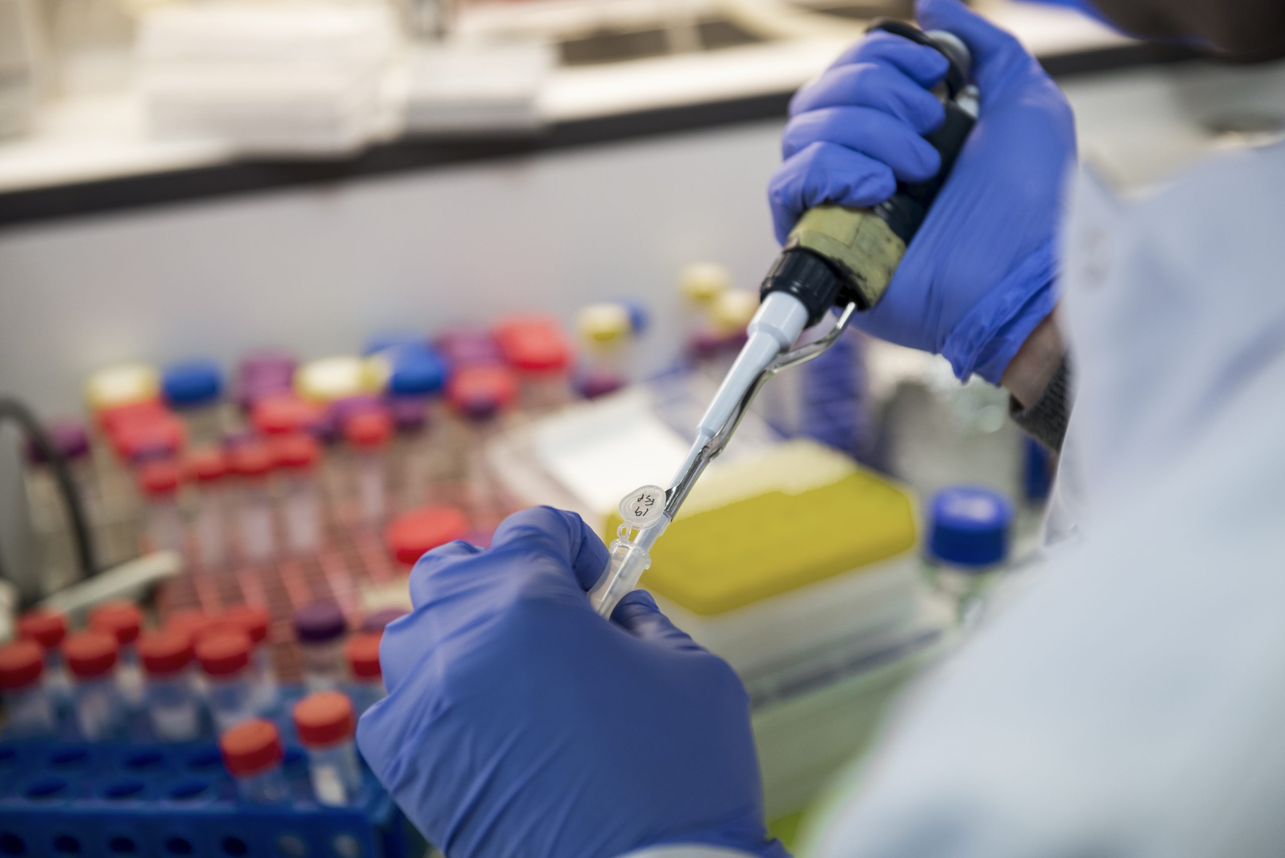 Gulbenkian investiga vírus SARS-CoV-2