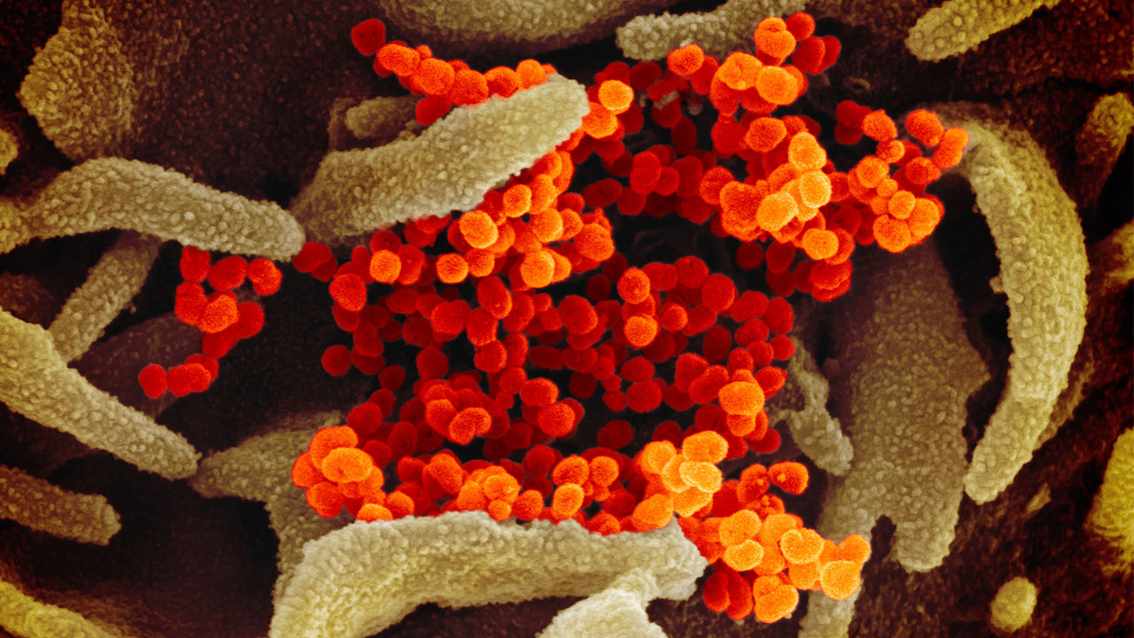 Science | Projeção da dinâmica de transmissão do SARS-CoV-2 durante o período pós-pandémico